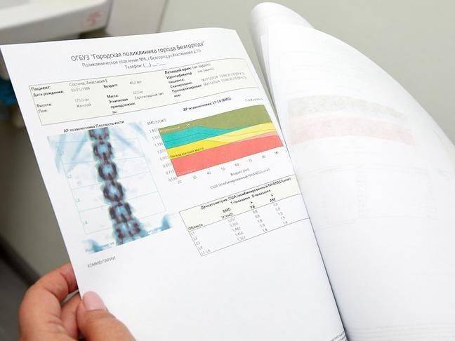 В поликлинике № 6 Белгорода появился аппарат для выявления остеопороза